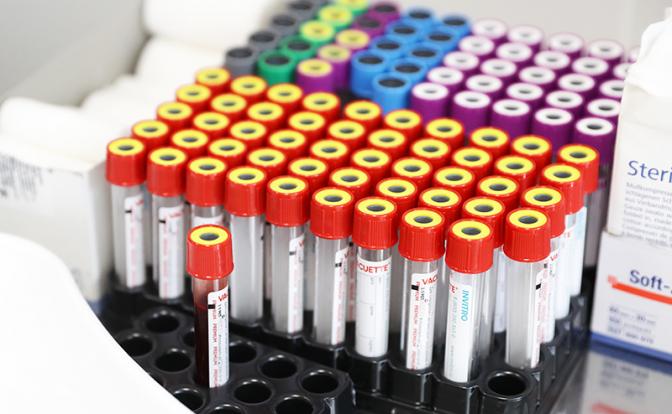 Ученые выяснили, люди с какой группой крови чаще страдают алкоголизмом