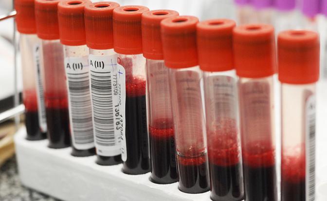 Назван предвестник рака крови