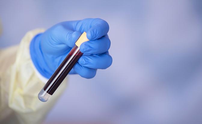 Показатели крови меняются за час: инфекционист рассказал о непредсказуемости коронавируса