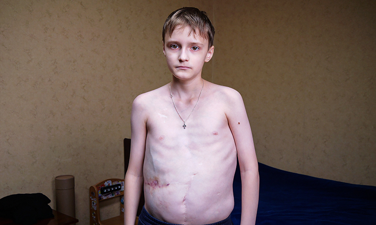  предоставлено Благотворительным фондом "Алёша"