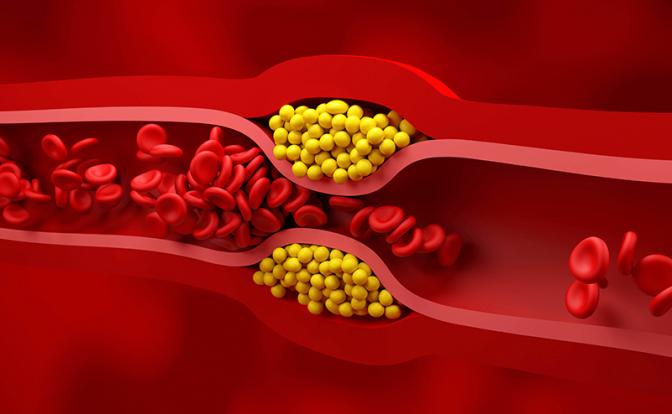 Названа одна из главных причин развития смертельно опасной болезни