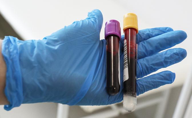 Врачи назвали ошибки, которые делают кровь густой