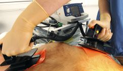 Озвучены симптомы, предшествующие моментальной остановке сердца