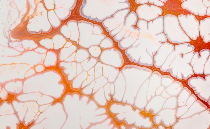 Названа ошибка, вызывающая разрыв сосудов и скорый инфаркт