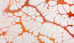 Названа ошибка, вызывающая разрыв сосудов и скорый инфаркт