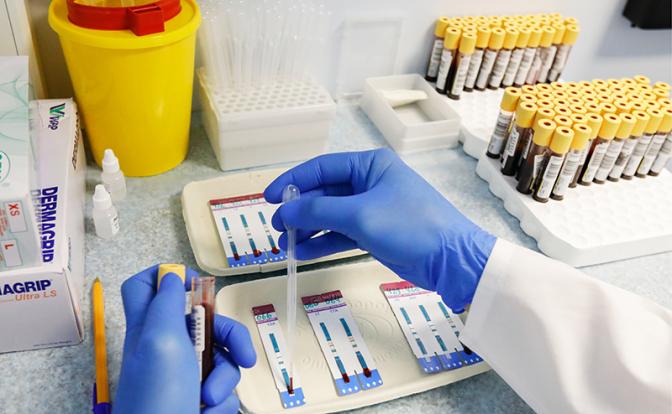 Обнаружен способ выявить скрытый ВИЧ в организме