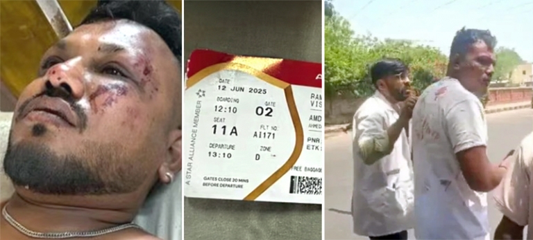 На фото: выживший в аивакатастрофе.