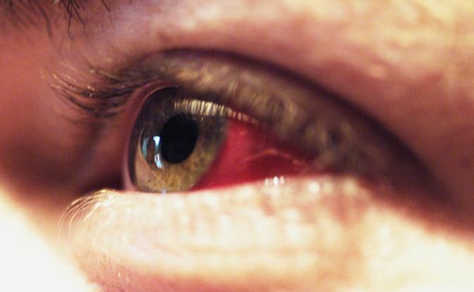 В Перми девушке выстрелили в глаз из пневматики во время пробежки