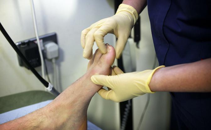 Россиян предупредили об опасности шишки на стопе