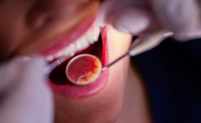 Стало известно, какие болезни могут разрушить зубы