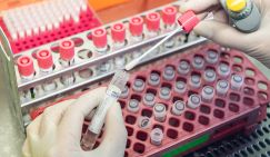 Завозной случай лихорадки чикунгунья впервые выявили в России