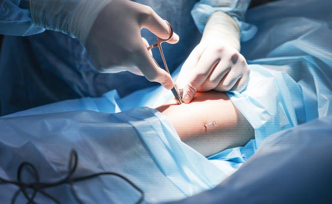 Эксперт назвал сигнал того, что к сосуду прирос опасный тромб