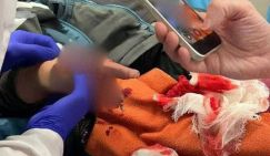 Десять рваных рублей: Мелкая купюра едва не лишила мальчика руки на детской площадке