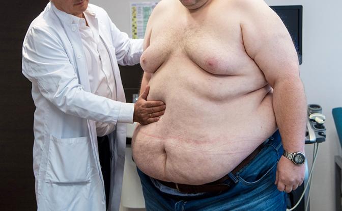 Слишком жирно – терять триллионы рублей из-за не в меру упитанных сограждан