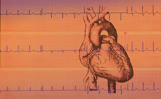 Перечислены "тихие" симптомы, которые годами ведут к инсульту