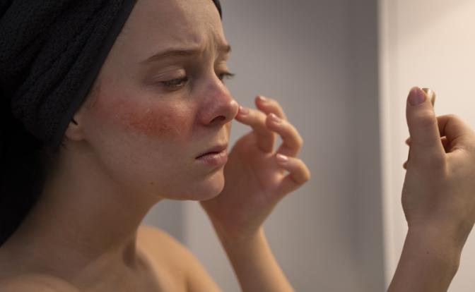 Врач раскрыл признаки «кортизолового» лица