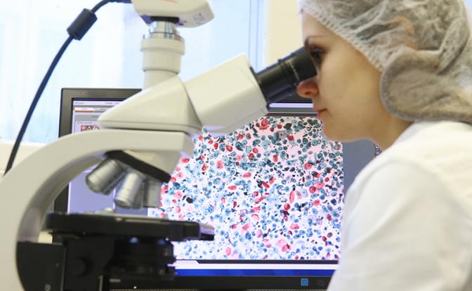 Учёные обнаружили ген, подавляющий развитие рака поджелудочной железы