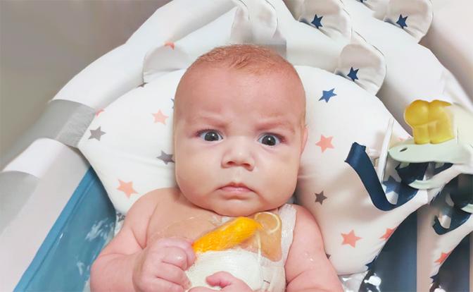 У пятимесячного Жени Евтушика всего 7 см кишечника – 3,5% от нормы