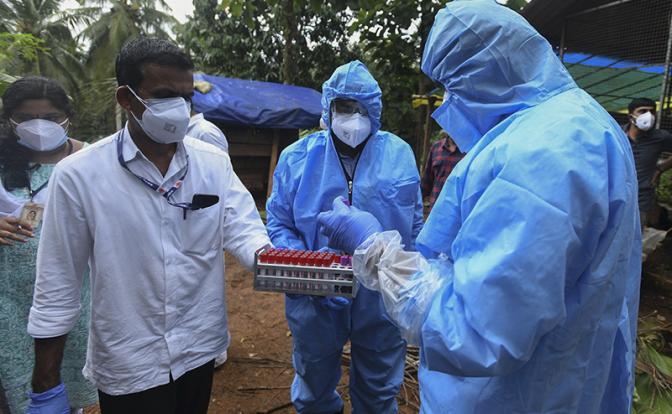 Роспотребнадзор рассказал о ситуации со смертельным вирусом Нипах в России