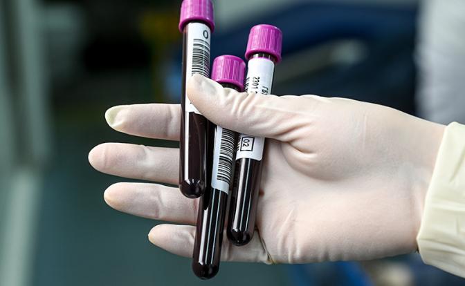 Озвучен способ предсказать продолжительность жизни по анализу крови