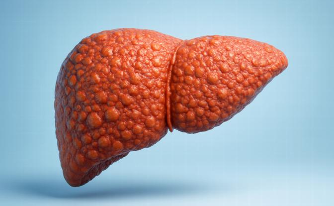 Назван простой способ восстановить печень даже при циррозе