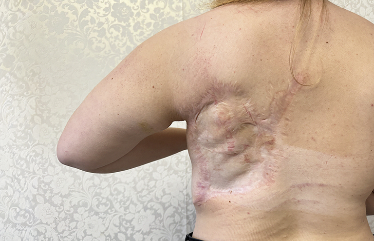 предоставлено Благотворительным фондом "Алёша"